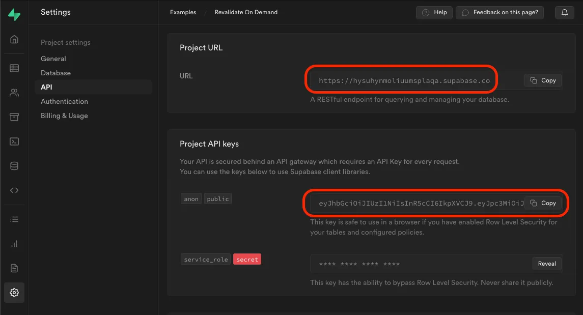 Supabase API Settings with URL and Anon Key highlighted
